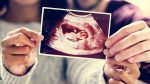 Life Within: Understanding Your Baby’s Movements
